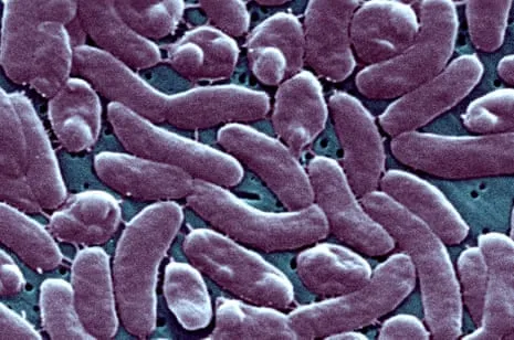 Louisiana Reports Five Deaths from Necrotizing Bacteria in Coastal Seawater